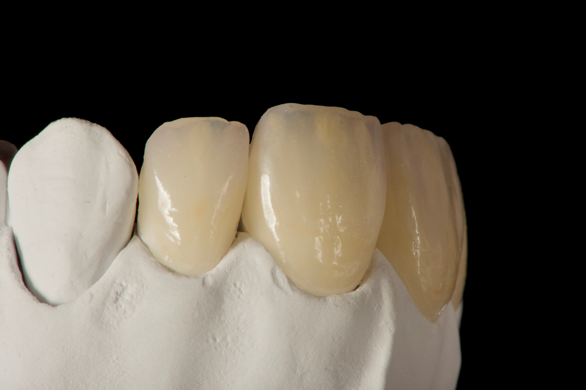 Dental lab work